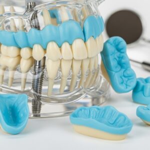 l'empreintes en implantologie